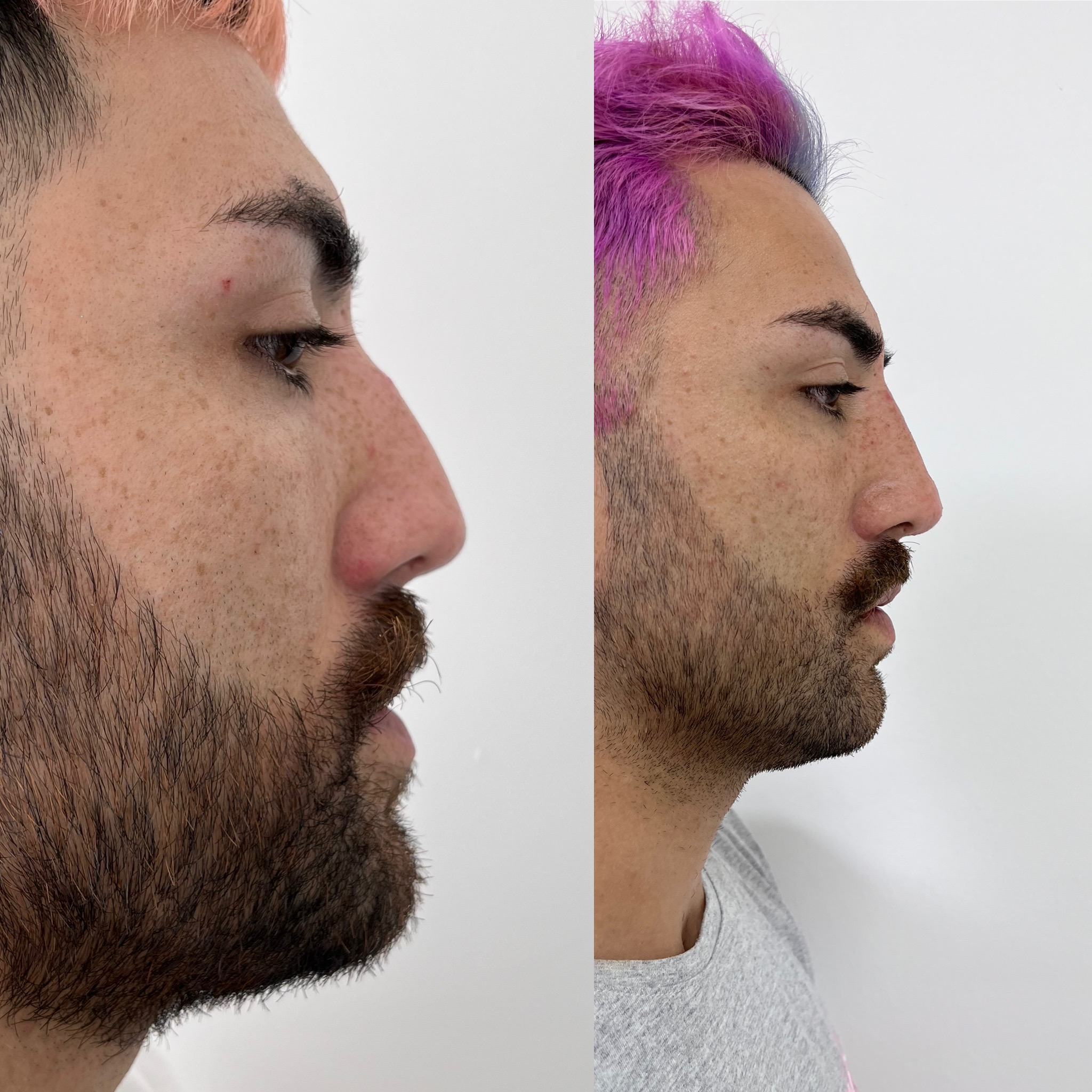 Transformación estética cuidada con resultado natural