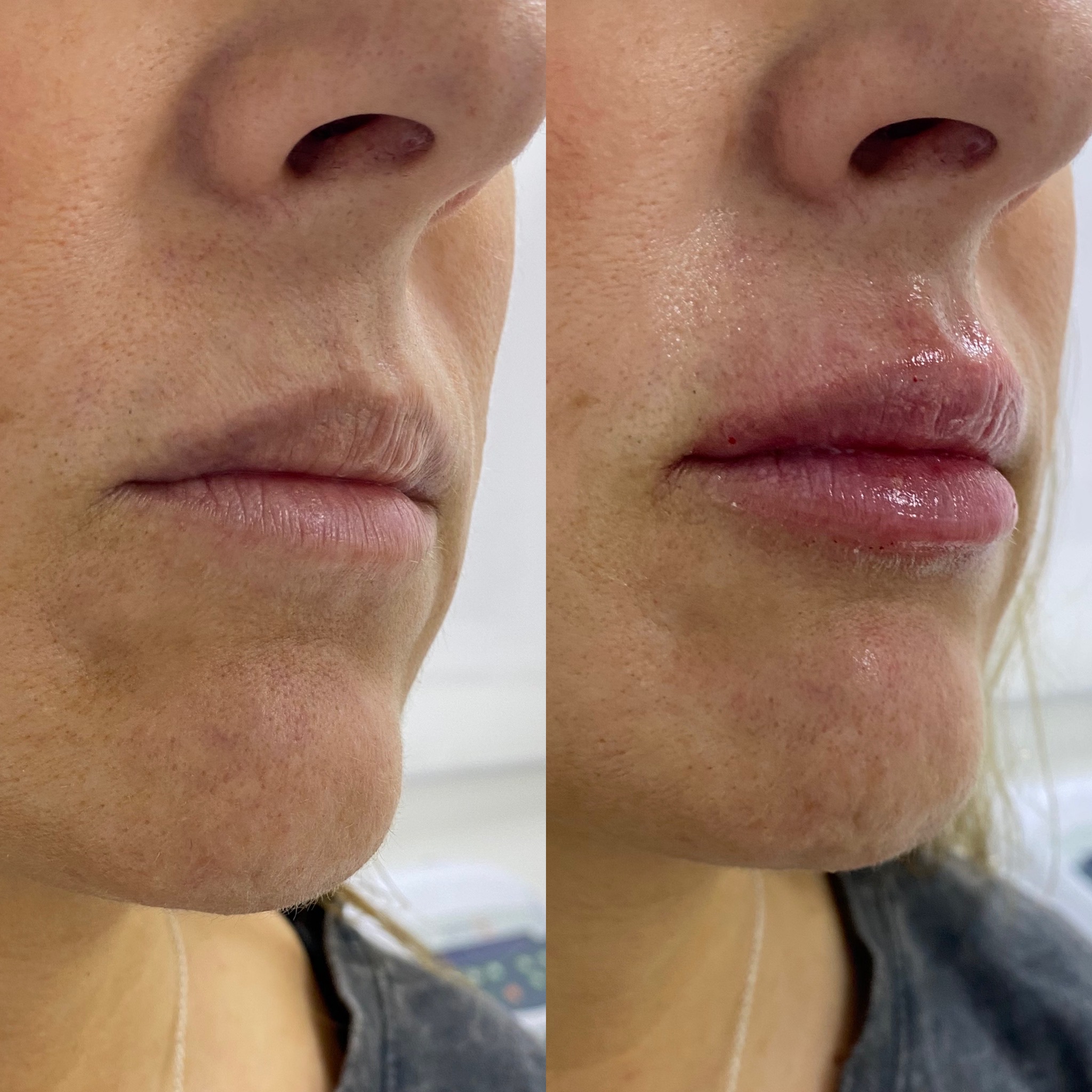 Mejora estética facial con acabado sutil y luminoso