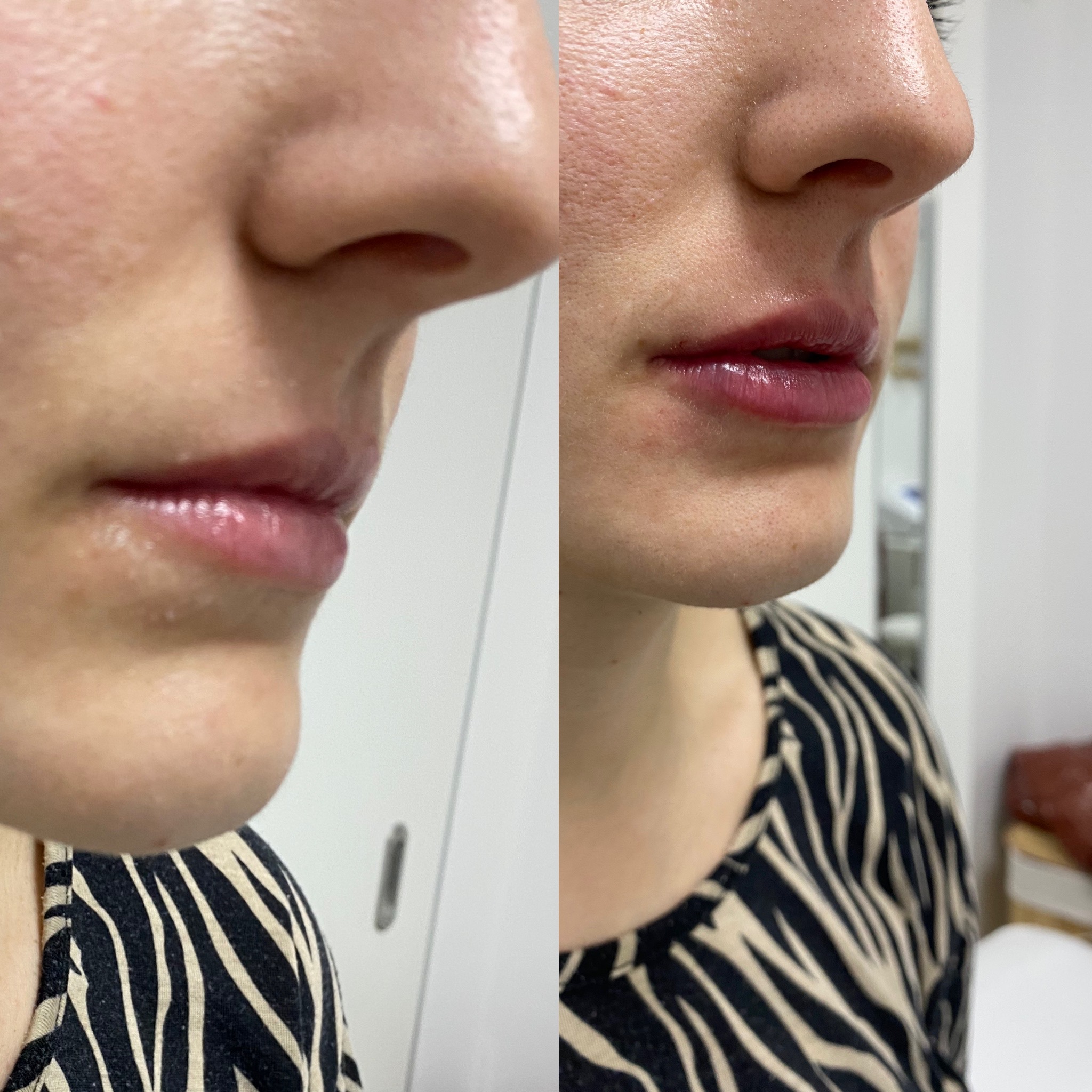 Resultado de medicina estética orientado a realzar la piel